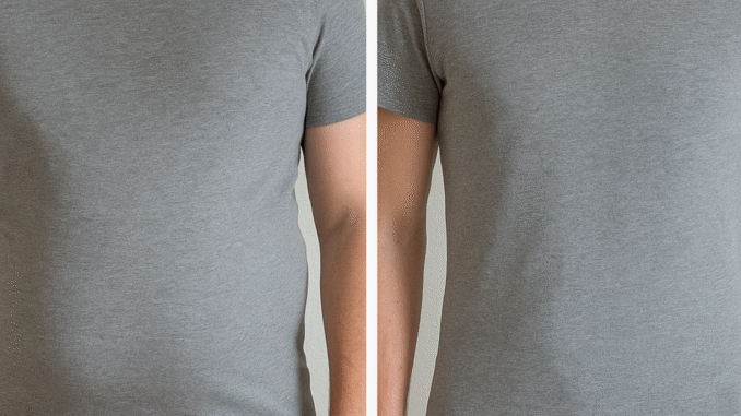 Før og efter billeder af slankekur